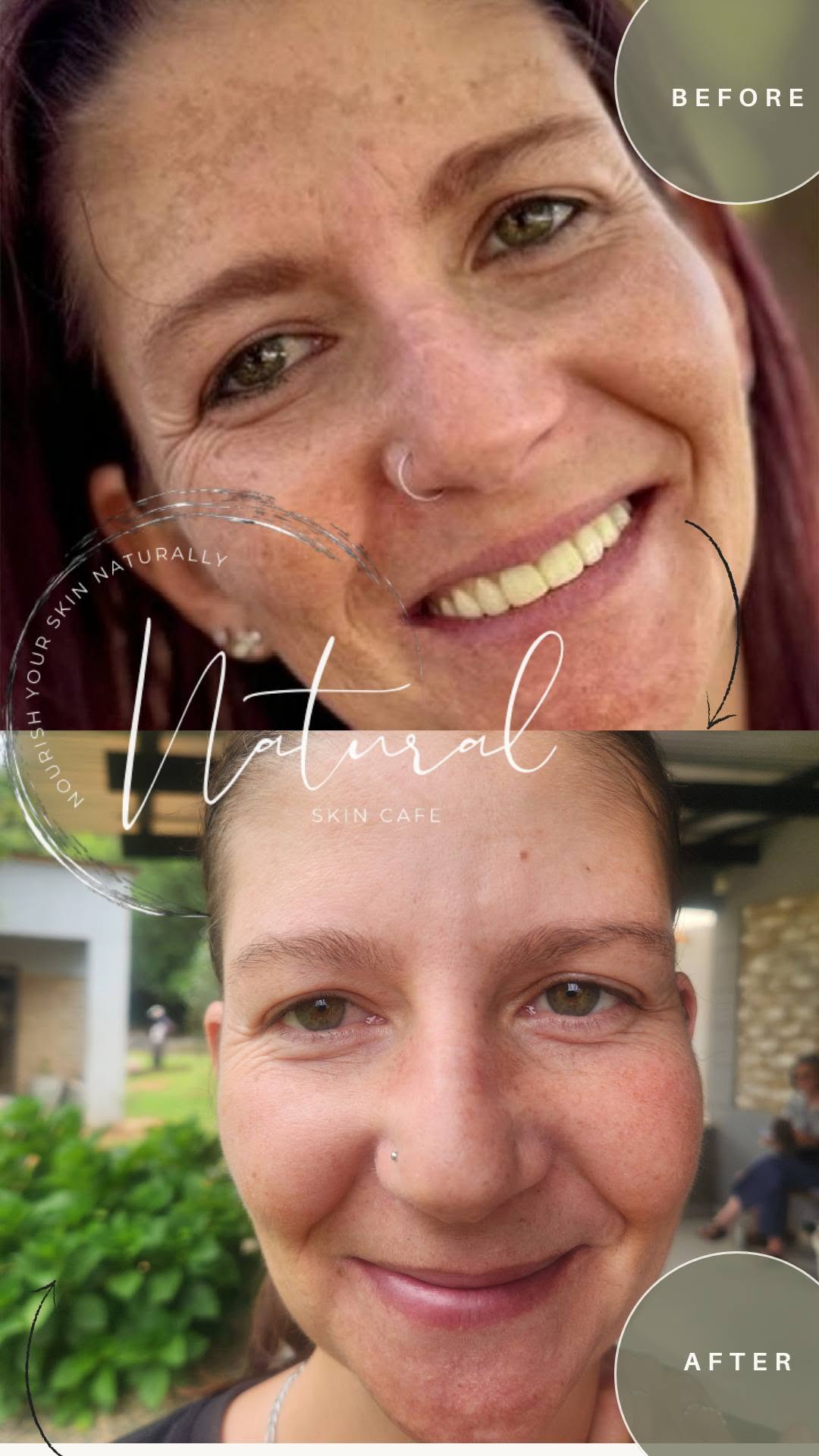 Natural Skin Café photo 4