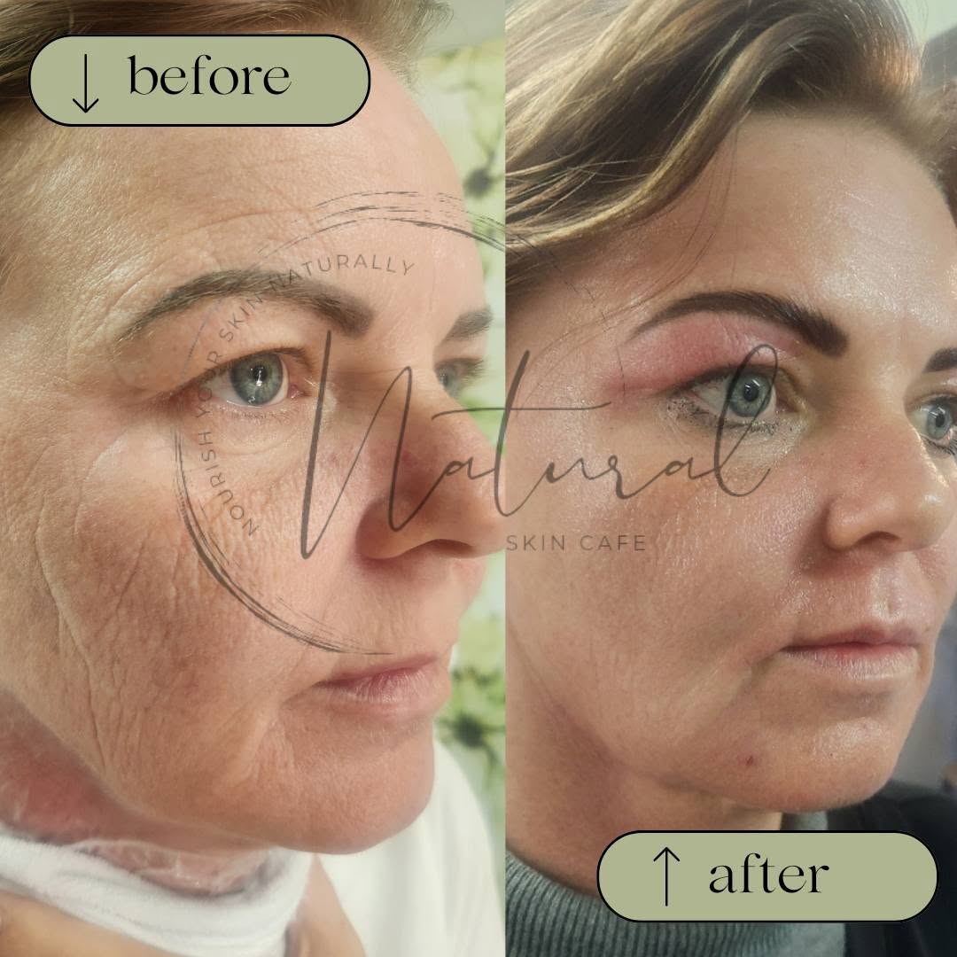Natural Skin Café photo 5